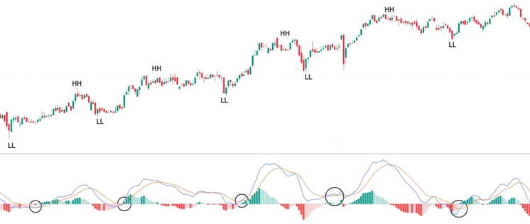 MACD